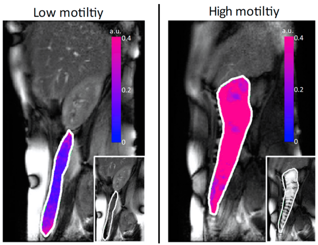 High vs low motility