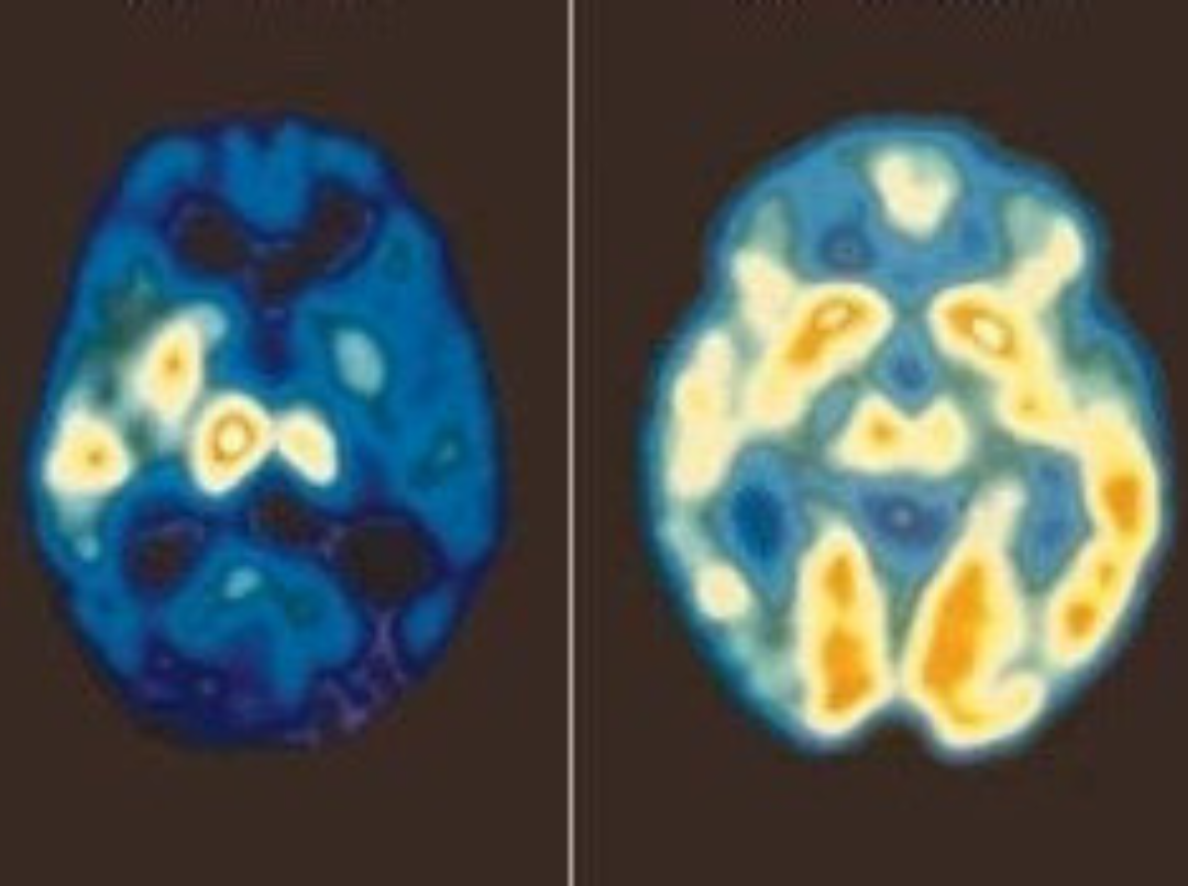Serotonin activity